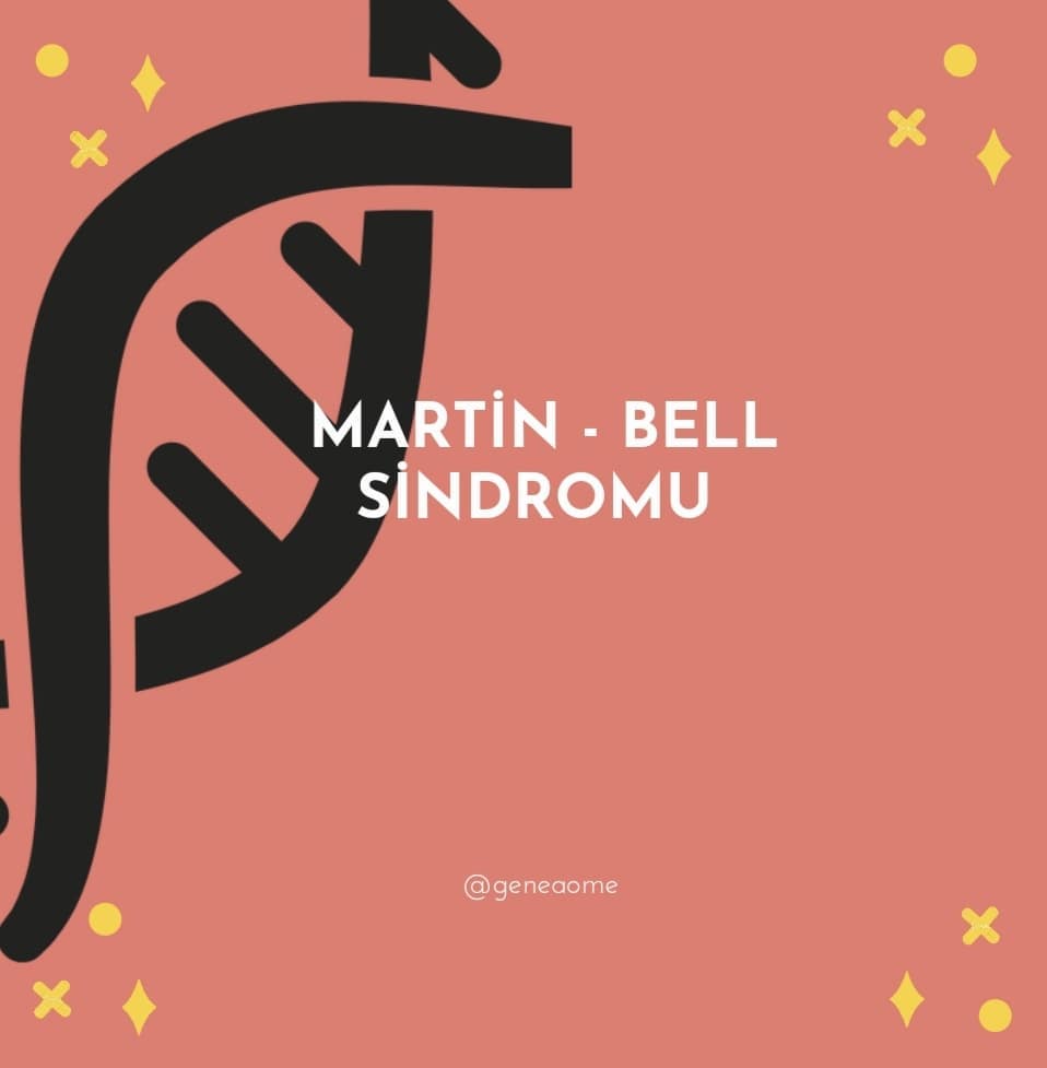 Martin-Bell sindromu nədir?