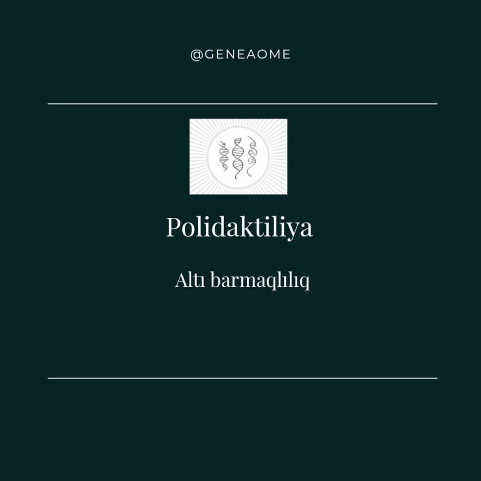 Polidaktiliya - Altı barmaqlılıq